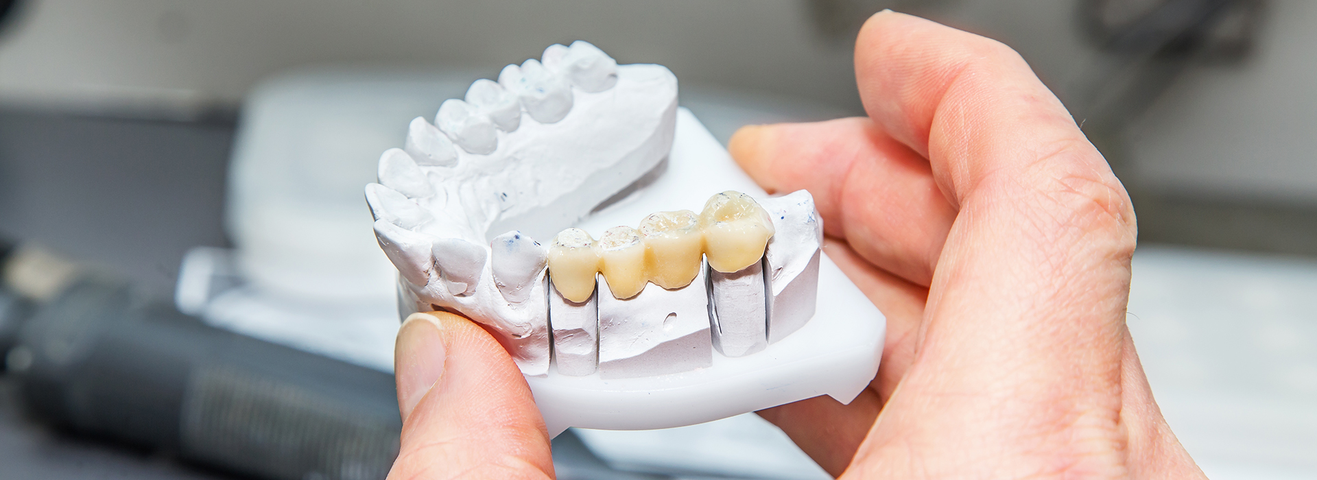 Alan S. Kuznick, DMD | Dental Bridges, Preventative Program and Dental Fillings